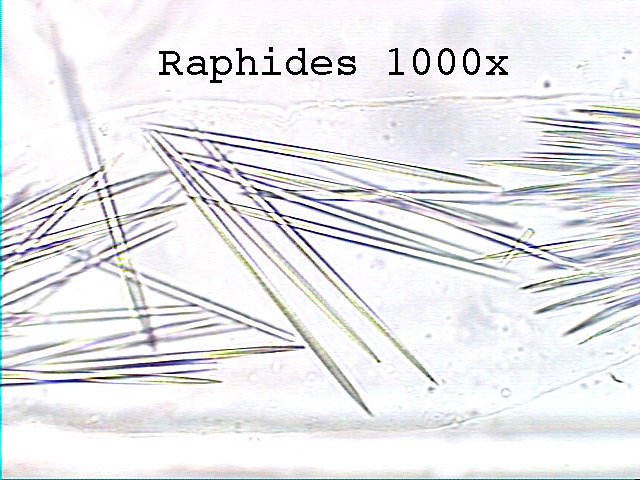 raphides-oxalate-article-anthony-berthou